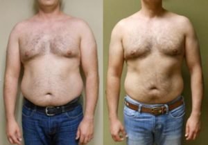 tipos de ectomorfo con panza